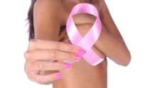 乳腺癌病因、临床表现、预防与治疗