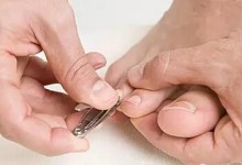 脚指甲长到肉里了？原来指甲应该这样剪
