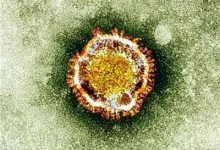 科普贴：怎么防治中东呼吸综合征？