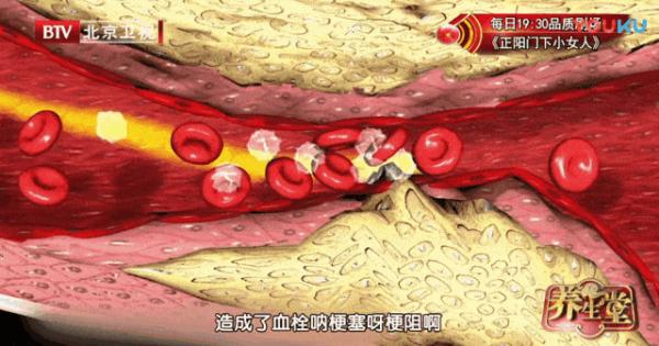 【健康】“软化血管”骗了国人30年，而真相只有一个！